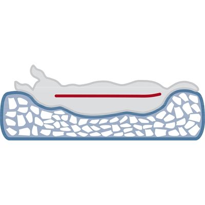 Trixie Vital Hondenkussen Bendson Orthopedisch Grijs